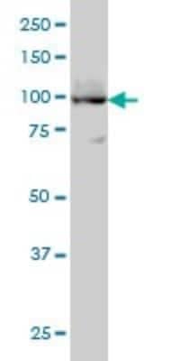 Western Blot: SERCA3 ATPase Antibody (2H3) [H00000489-M01]