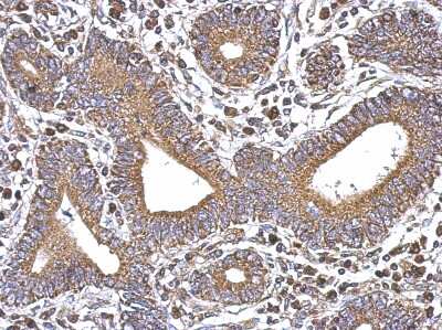 Immunohistochemistry-Paraffin: SERCA3 ATPase Antibody [NBP2-20306]