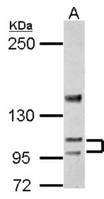 Western Blot: SERCA3 ATPase Antibody [NBP2-20306]