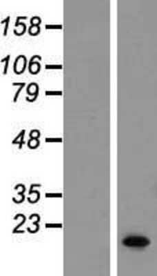 Western Blot: SERF1A Overexpression Lysate [NBP2-06493]