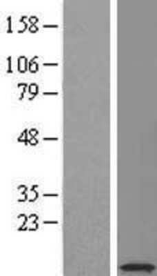 Western Blot: SERF2 Overexpression Lysate [NBL1-15825]