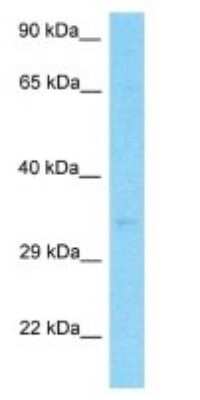 Western Blot: SERHL2 Antibody [NBP3-09374]