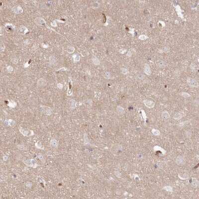 Immunohistochemistry-Paraffin: SERINC1 Antibody [NBP1-81422]
