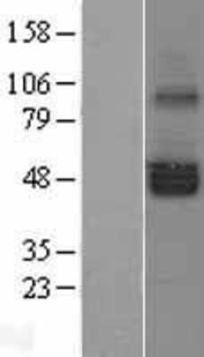 Western Blot: SERINC1 Overexpression Lysate [NBL1-15828]