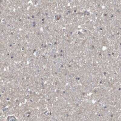 Immunohistochemistry-Paraffin: SERINC2 Antibody [NBP1-87927]