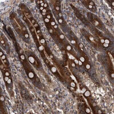 Immunohistochemistry-Paraffin: SERINC2 Antibody [NBP1-87927]