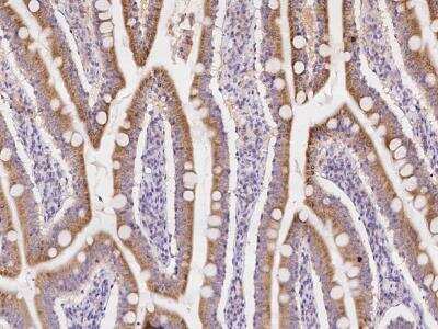 Immunohistochemistry-Paraffin: SERINC2 Antibody [NBP3-06100]