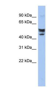 Western Blot: SERINC2 Antibody [NBP1-60102]