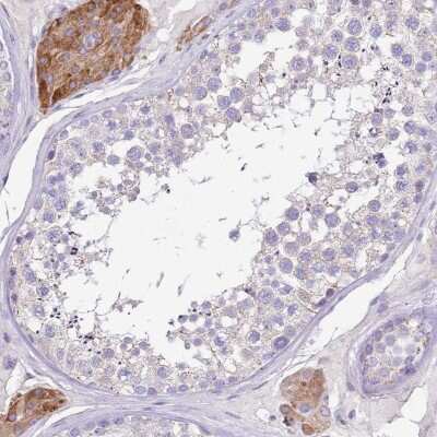 Immunohistochemistry-Paraffin: SERINC3 Antibody [NBP2-13296]