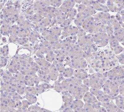 Immunohistochemistry-Paraffin: SERINC3 Antibody [NBP2-13296]