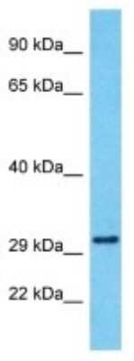 Western Blot: SERINC4 Antibody [NBP3-09887]