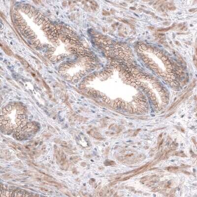 Immunohistochemistry-Paraffin: SERINC5 Antibody [NBP2-38369]