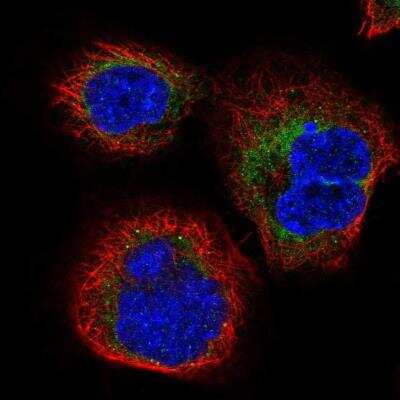 Immunocytochemistry/ Immunofluorescence: SERP1 Antibody [NBP2-54686]