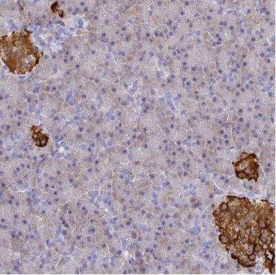 Immunohistochemistry-Paraffin: SERP1 Antibody [NBP2-54686]