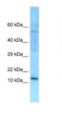 Western Blot: SERP1 Antibody [NBP1-98592]