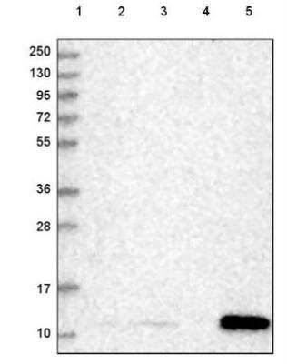 Western Blot: SERP1 Antibody [NBP2-54686]