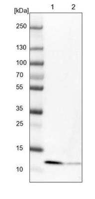 Western Blot: SERP1 Antibody [NBP2-54686]