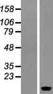 Western Blot: SERP1 Overexpression Lysate [NBL1-15831]