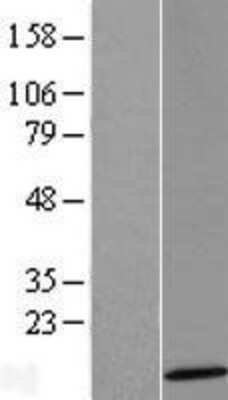 Western Blot: SERP2 Overexpression Lysate [NBL1-15832]