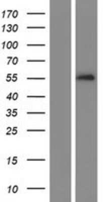 Western Blot: Serpin A10/ZPI Overexpression Lysate [NBL1-15836]