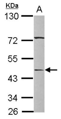 Western Blot: Serpin A12 Antibody [NBP2-15117]