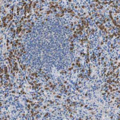Immunohistochemistry-Paraffin: SERPINB1 Antibody [NBP1-89072]