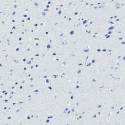 Immunohistochemistry-Paraffin: SERPINB1 Antibody [NBP1-89072]