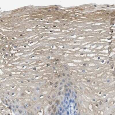 Immunohistochemistry-Paraffin: SERPINB1 Antibody [NBP1-89072]