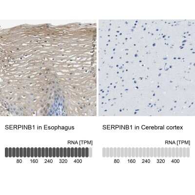 Immunohistochemistry-Paraffin: SERPINB1 Antibody [NBP1-89072]
