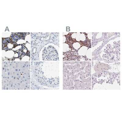Immunohistochemistry-Paraffin: SERPINB1 Antibody [NBP1-89072]