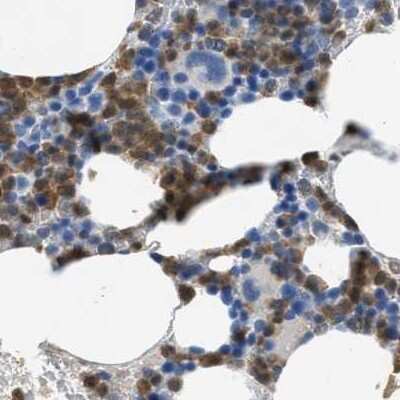 Immunohistochemistry-Paraffin: SERPINB1 Antibody [NBP1-89072]