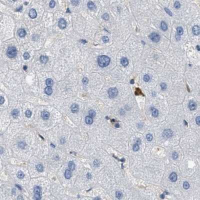 Immunohistochemistry-Paraffin: SERPINB1 Antibody [NBP1-89072]