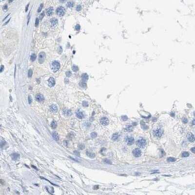 Immunohistochemistry-Paraffin: SERPINB1 Antibody [NBP1-89072]