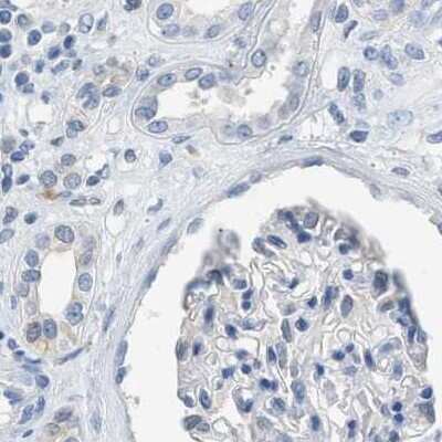 Immunohistochemistry-Paraffin: SERPINB1 Antibody [NBP1-89072]