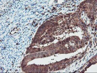 Immunohistochemistry: SERPINB1 Antibody (OTI3B4) - Azide and BSA Free [NBP2-74123]