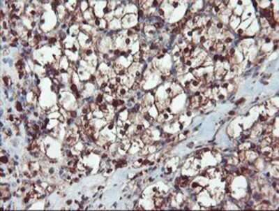 Immunohistochemistry: SERPINB1 Antibody (OTI3B4) - Azide and BSA Free [NBP2-74123]