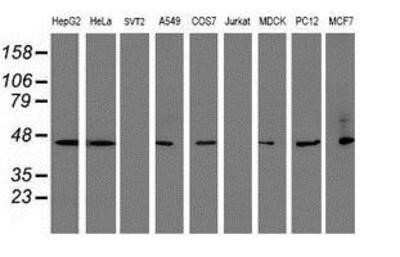 Western Blot: SERPINB1 Antibody (OTI3B4)Azide and BSA Free [NBP2-74123]