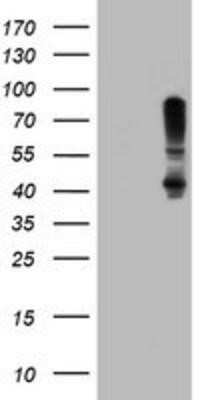 Western Blot: SERPINB1 Antibody (OTI3B4)Azide and BSA Free [NBP2-74123]