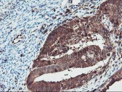 Immunohistochemistry-Paraffin: SERPINB1 Antibody (OTI3B4) [NBP2-03828]