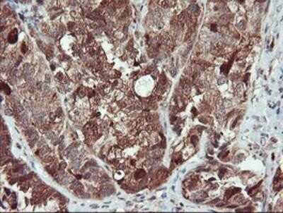 Immunohistochemistry-Paraffin: SERPINB1 Antibody (OTI3B4) [NBP2-03828]