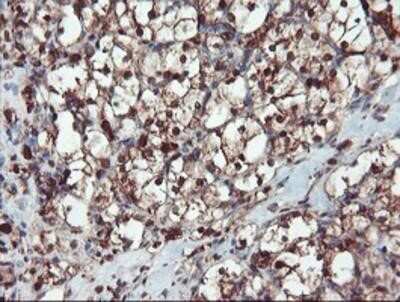Immunohistochemistry-Paraffin: SERPINB1 Antibody (OTI3B4) [NBP2-03828]