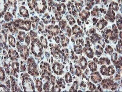 Immunohistochemistry-Paraffin: SERPINB1 Antibody (OTI3B4) [NBP2-03828]