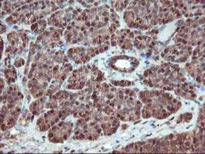 Immunohistochemistry-Paraffin: SERPINB1 Antibody (OTI3B4) [NBP2-03828]