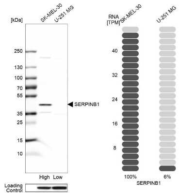 Western Blot: SERPINB1 Antibody [NBP1-89072]