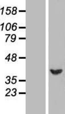 Western Blot: SERPINB1 Overexpression Lysate [NBL1-15842]