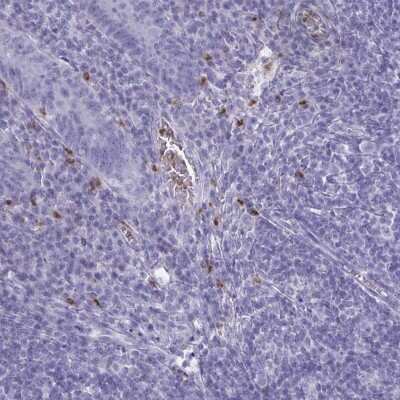 Immunohistochemistry-Paraffin: SERPINB10 Antibody [NBP2-38876]