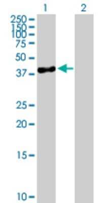 Western Blot: SERPINB10 Antibody [H00005273-B01P]