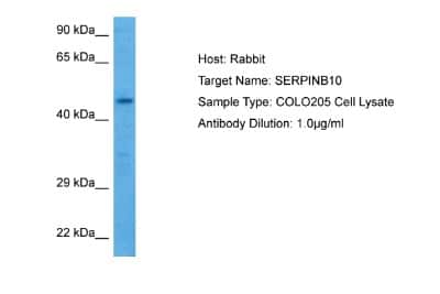 Western Blot: SERPINB10 Antibody [NBP2-88243]