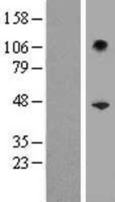 Western Blot: SERPINB10 Overexpression Lysate [NBP2-07803]