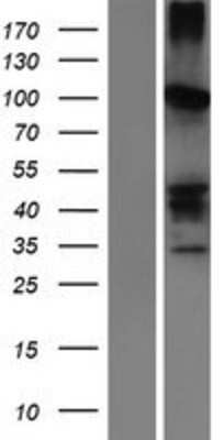 Western Blot: SERPINB11 Overexpression Lysate [NBP2-05784]